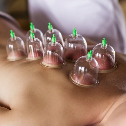 physical-therapy-clinic-cupping-UNIQ-physical-therapy-warminster-pa