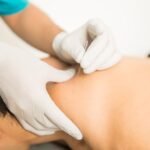 dry-needling-therapy - UPT